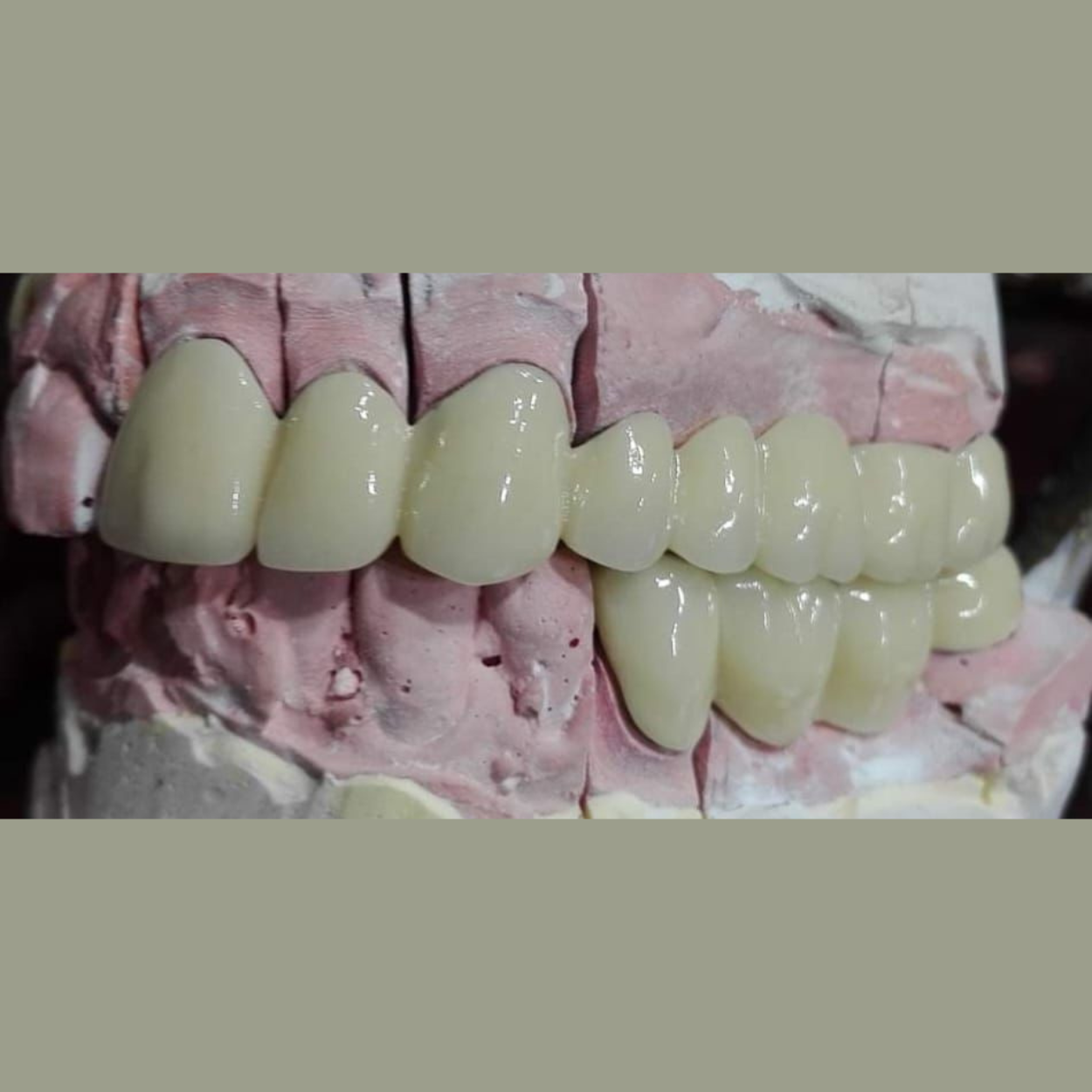 Multilayered Zirconia Blank